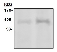 1 - PARP Antibody (Clone 2B6) ABV11803