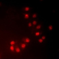 3 - Phospho-NIFK (Thr234) Antibody ABV11851