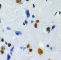 2 - Phospho-NIFK (Thr234) Antibody ABV11851