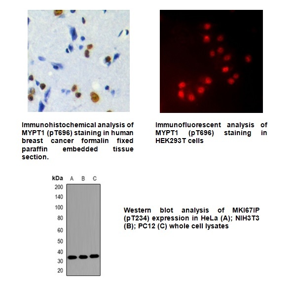 1 - Phospho-NIFK (Thr234) Antibody ABV11851