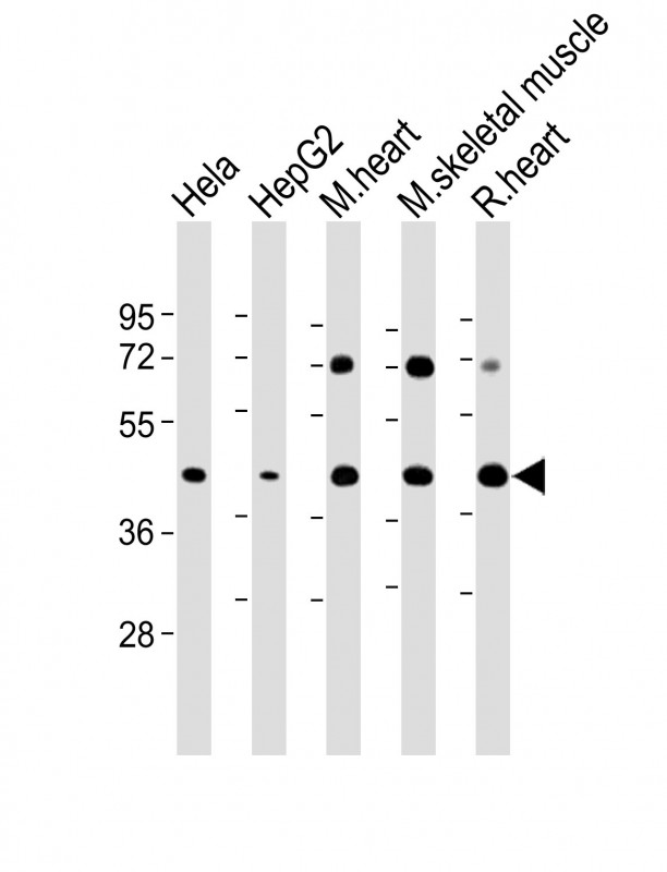 1 - GYG1 Antibody (C-Term) AP22264b