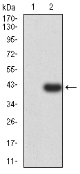 1 - Mouse Monoclonal Antibody to PSMC3 AO2374a
