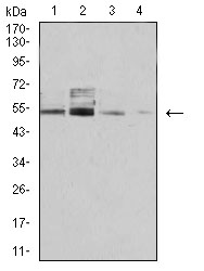 1 - Mouse Monoclonal Antibody to PSMC3 AO2374a