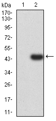1 - Mouse Monoclonal Antibody to SUZ12 AO2381a