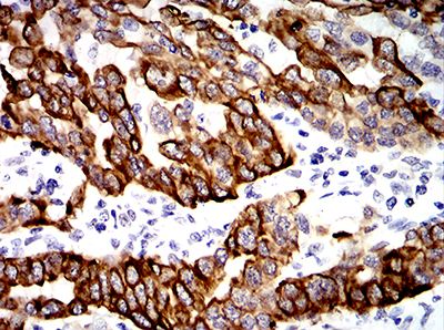 2 - Mouse Monoclonal Antibody to KRT19 AO2460a