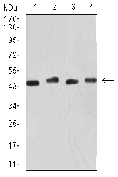 1 - Mouse Monoclonal Antibody to KRT19 AO2460a