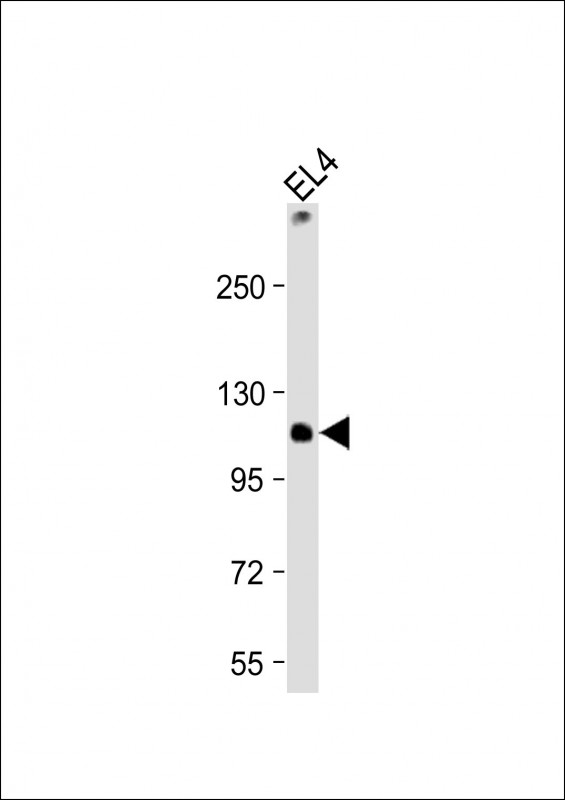 1 - TCIRG1 Antibody (C-Term) AP22308b
