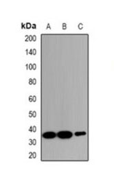 1 - Anti-ZNT2 Antibody ABV11926