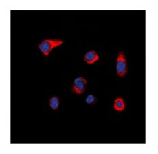 3 - Anti-PIP5K Antibody ABV11968