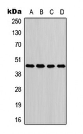 1 - Anti-GOT1 Antibody  ABV12003
