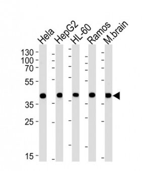 1 - Anti-GOT2 Antibody ABV12004