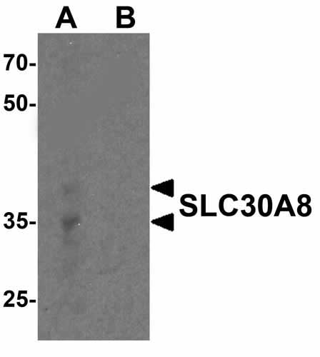1 - SLC30A8 Antibody ASC12029