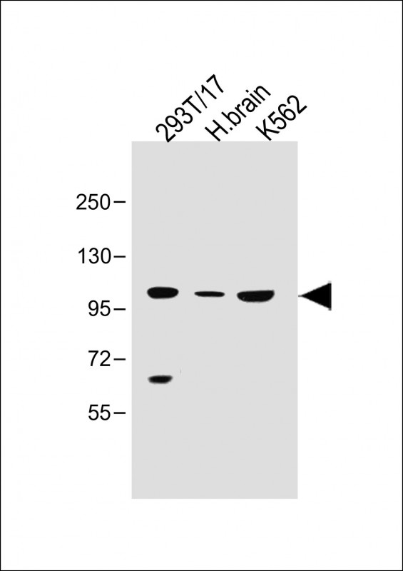 1 - SLC14A2 Antibody (N-Term) AP22353a