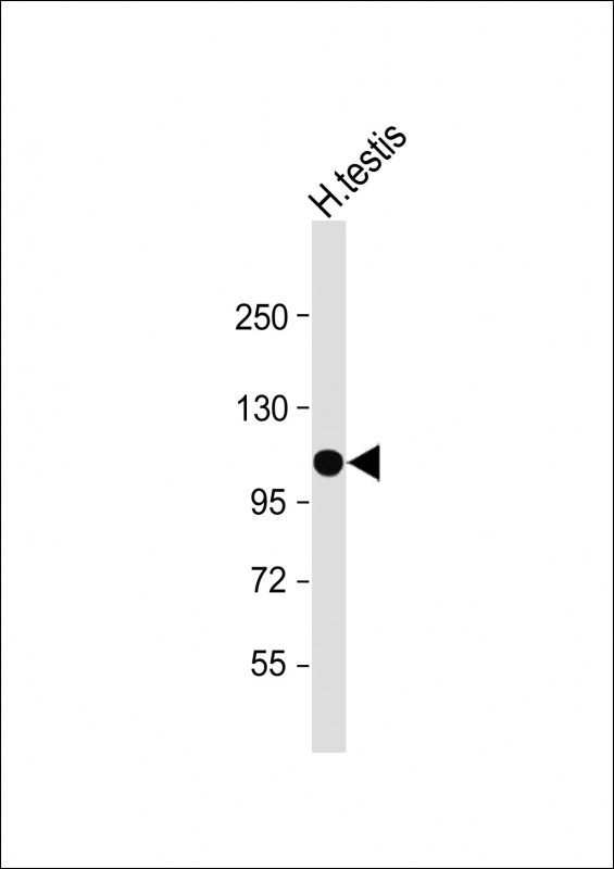 1 - SLC14A2 Antibody (N-Term) AP22353a