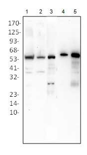 1 - Anti-Catalase Antibody ABV12042