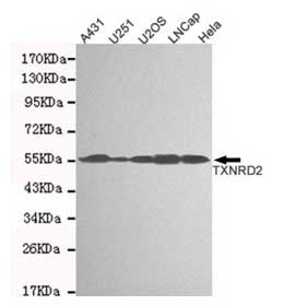 1 - Anti-TXNRD2 Antibody (3F2-E12-F10) ABV12055