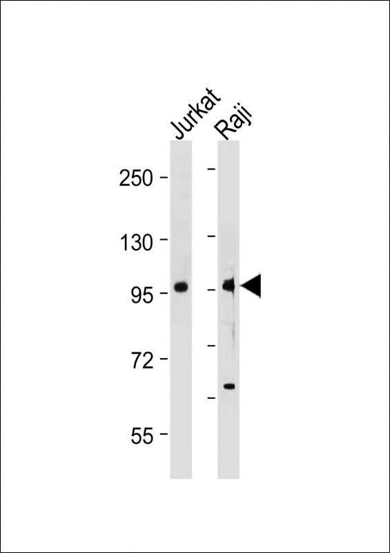 1 - MAP4K1(Y381) Antibody AP22375a