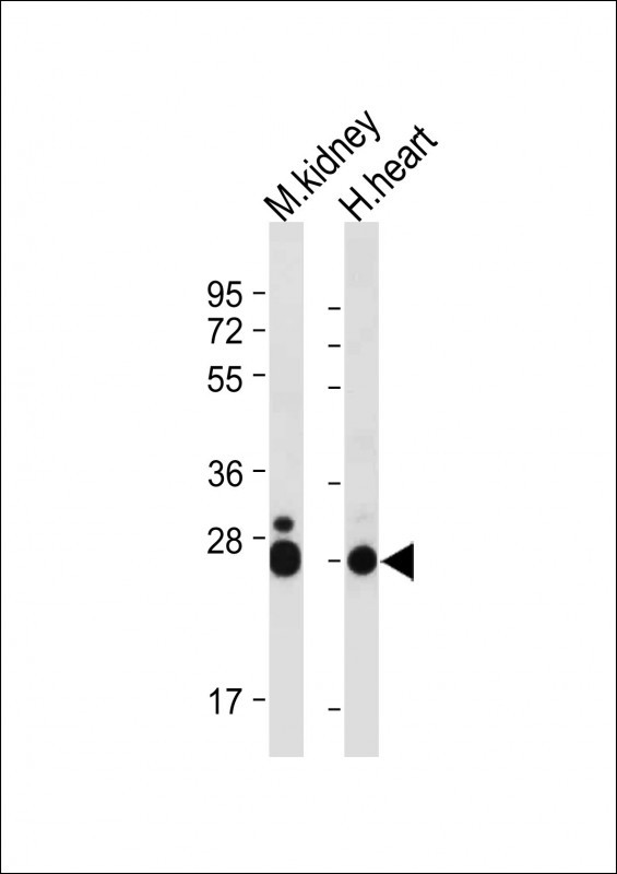 1 - MARCH5 Antibody (N-term) AP5677a
