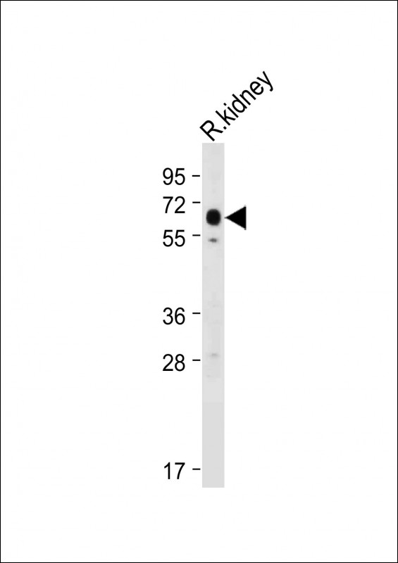 1 - S47A2 Antibody (N-term) AP4722a