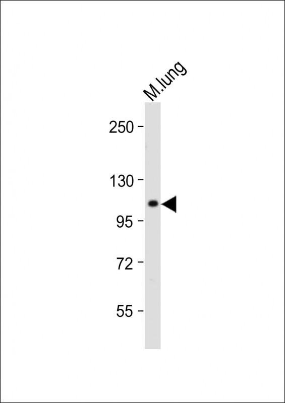 1 - RHBDF2 Antibody (N-term) AP13588A