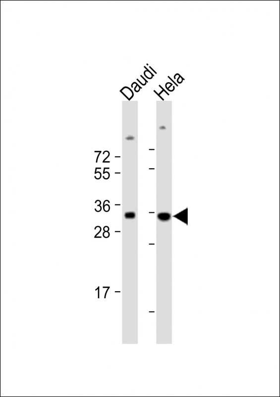 1 - BCKDHB Antibody (N-term) AP10672a