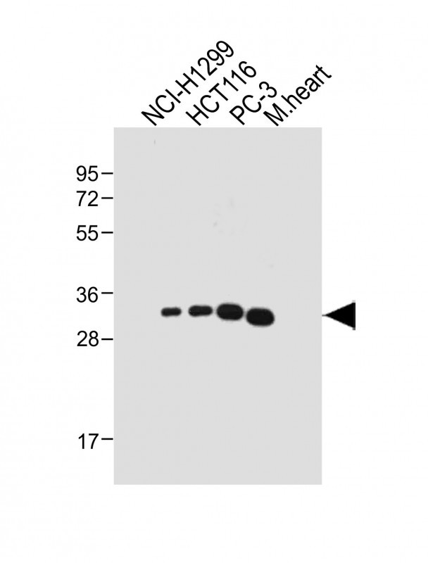 1 - VDAC2 Antibody (N-term) AP21559a