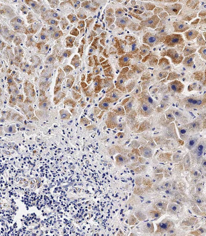 59 - BCKDHB Antibody (N-term) AP10672a