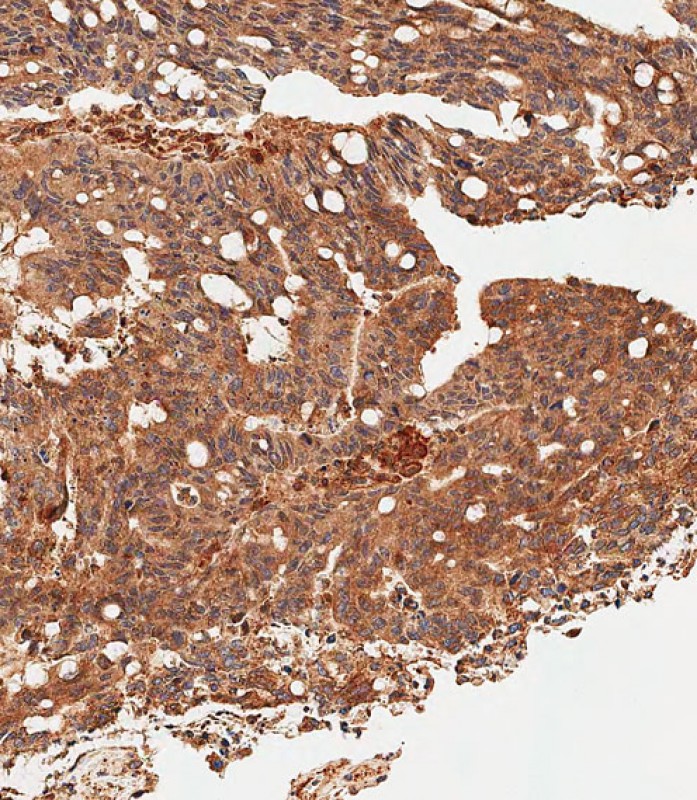 59 - SLC16A3 Antibody (C-term) AP12397b