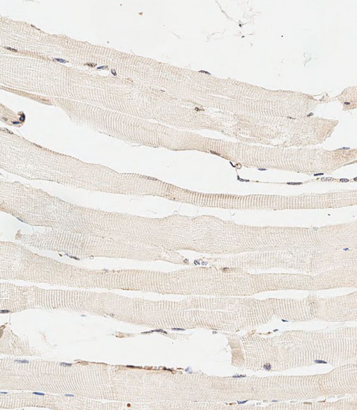 59 - HYAL4 Antibody (Center) AP13683C