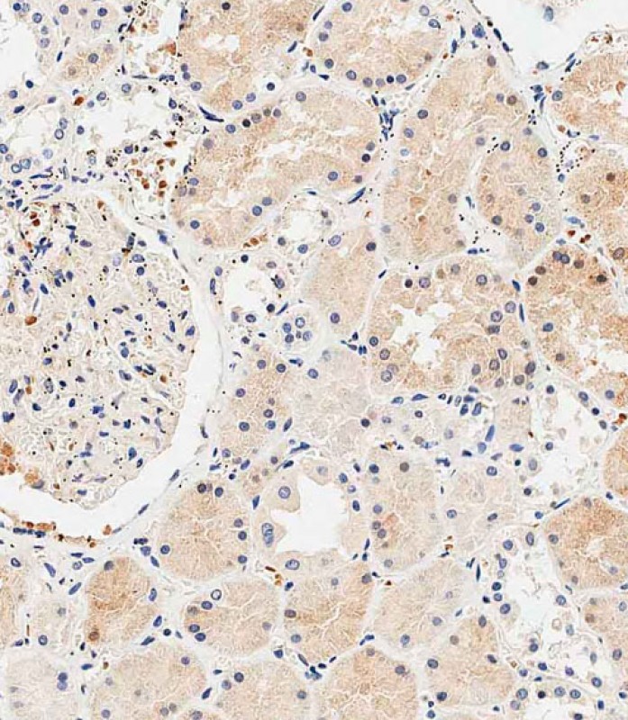 59 - USP30 Antibody (N-term) AP14725a
