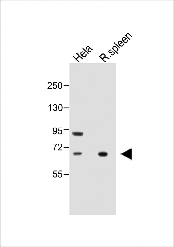 1 - ALOX12 Antibody (C-term) AP8877B