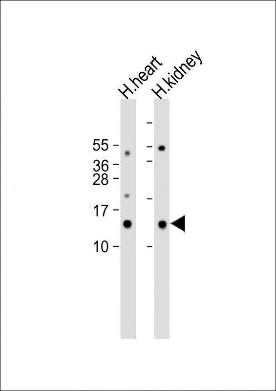 1 - ND3 Antibody (N-term) AP12310a