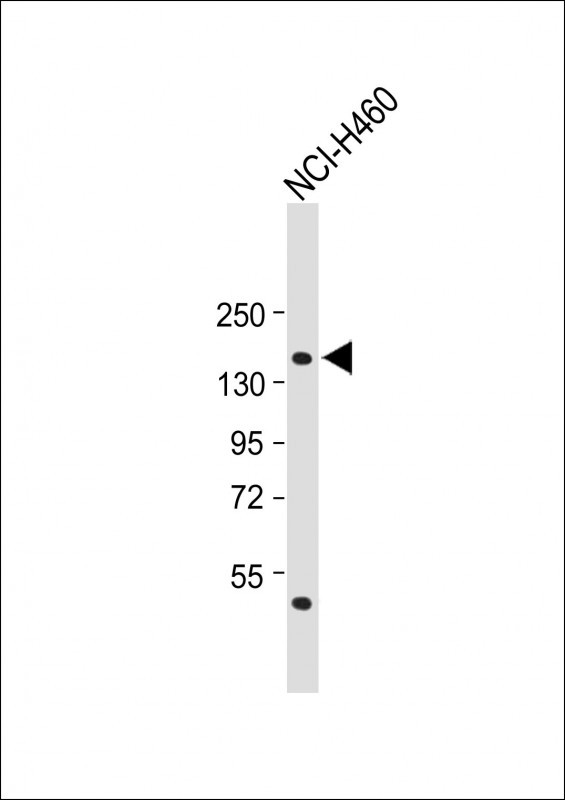 1 - NPC1 Antibody (Center) AP13472c