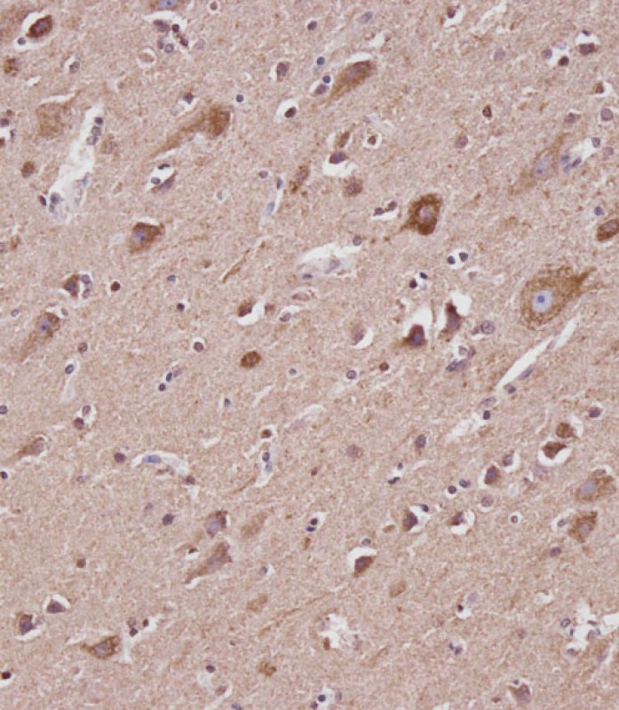 14 - VDAC2 Antibody (N-term) AP21559a