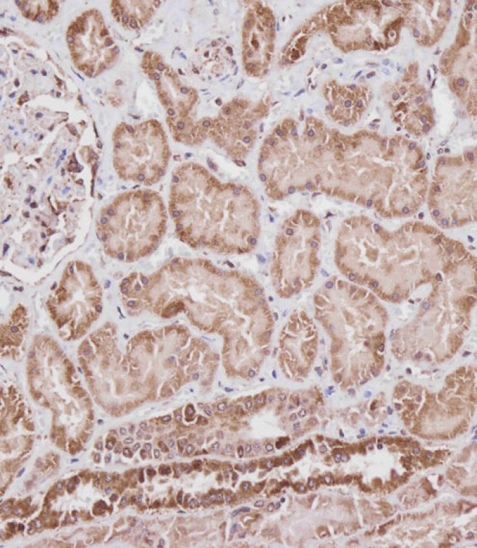 14 - VDAC2 Antibody (N-term) AP21559a