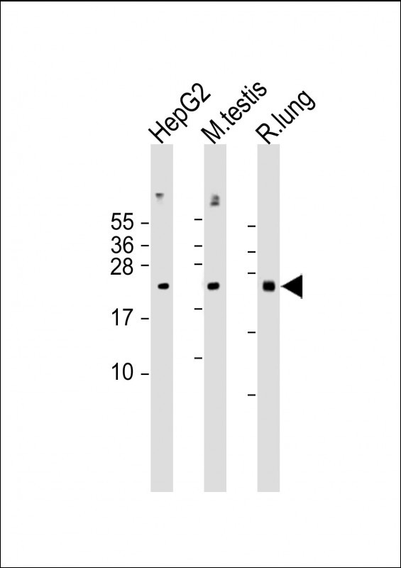 1 - NRAS Antibody (N-term) AP7745A