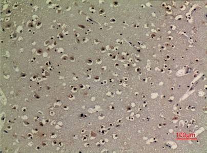 14 - p73 (Acetyl Lys321) Polyclonal Antibody AP63234