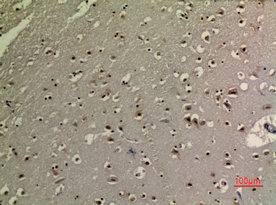 14 - p73 (Acetyl Lys321) Polyclonal Antibody AP63234