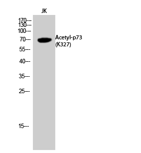 1 - p73 (Acetyl Lys327) Polyclonal Antibody AP63235