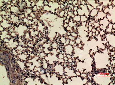 14 - Nrf2 (Acetyl Lys599) Polyclonal Antibody AP63260