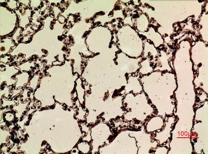14 - Nrf2 (Acetyl Lys599) Polyclonal Antibody AP63260