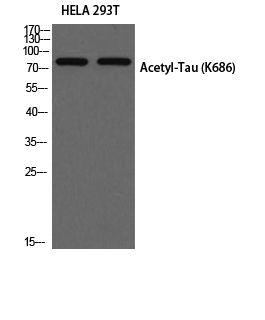 1 - Tau (Acetyl Lys686) Polyclonal Antibody AP63269