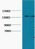 1 - Collagen III Monoclonal Antibody(Q76) AP63370