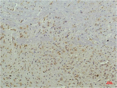 14 - PPAR Delta mouse Monoclonal Antibody(2F9) AP63723
