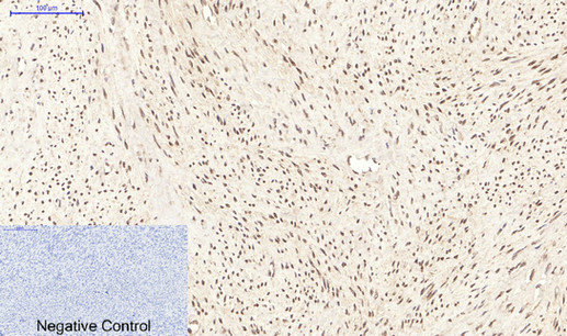 14 - PPAR Delta mouse Monoclonal Antibody(2F9) AP63723