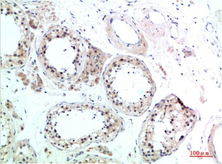 1 - HSC70 Rabbit Polyclonal Antibody AP63801
