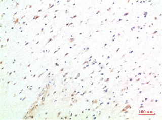 14 - HSC70 Rabbit Polyclonal Antibody AP63801