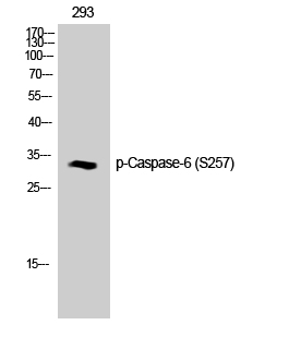 1 - Caspase-6 (phospho Ser257) Polyclonal Antibody AP66976