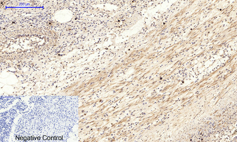 14 - JNK1/2/3 (phospho Thr183/Y185) Polyclonal Antibody AP67089