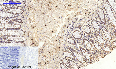14 - JNK1/2/3 (phospho Thr183/Y185) Polyclonal Antibody AP67089